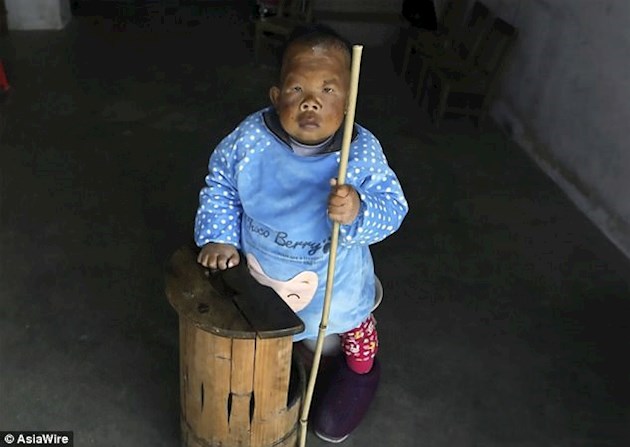 Странная болезнь превратила жителя Китая в маленького ребенка навсегда: медики называют сенсацией то, что Ван Тянфан до сих пор живет, - кадры