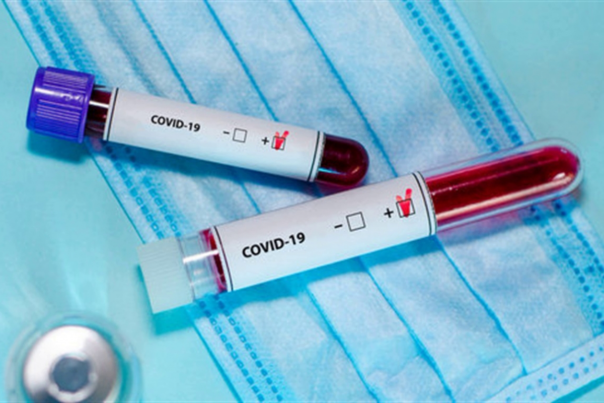 ​Четвертый антирекорд COVID-19 в Украине: Харьковщина вышла в лидеры по темпам роста