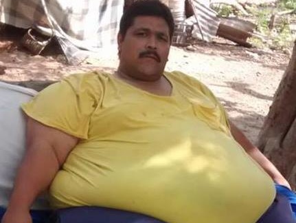 Смерть от чревоугодия: в Мексике умер самый толстый человек на планете 