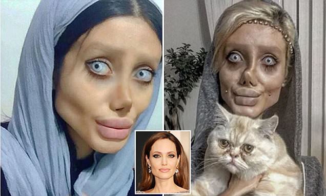 Людям со слабой психикой этого лучше не видеть: дама мечтала стать похожей на Анджелину Джоли, но пластические хирурги превратили ее в персонажа фильма ужасов – кадры
