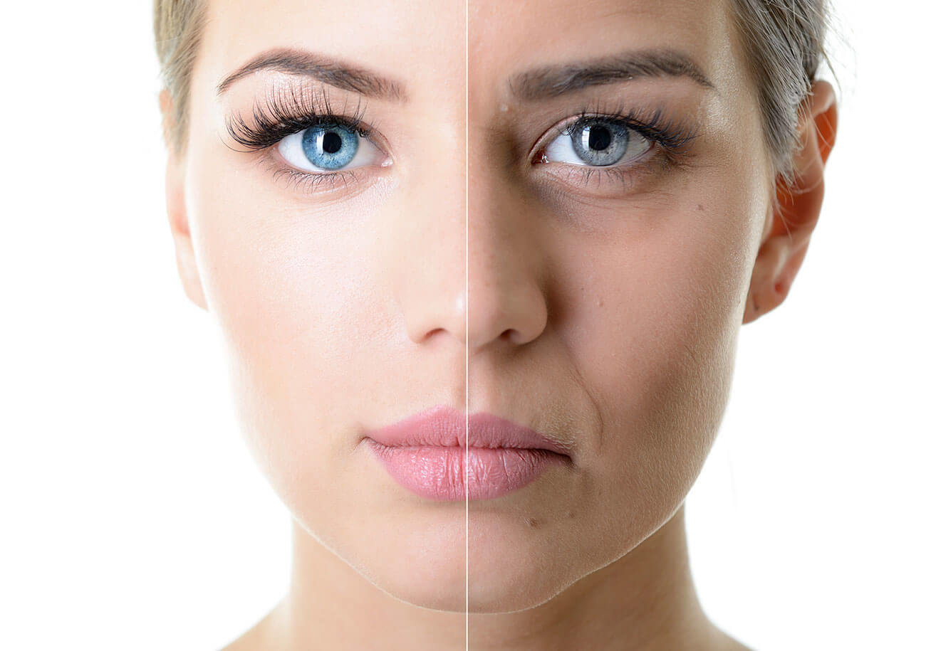 Типы старения кожи лица: главные признаки и особенности каждого из 4 типов