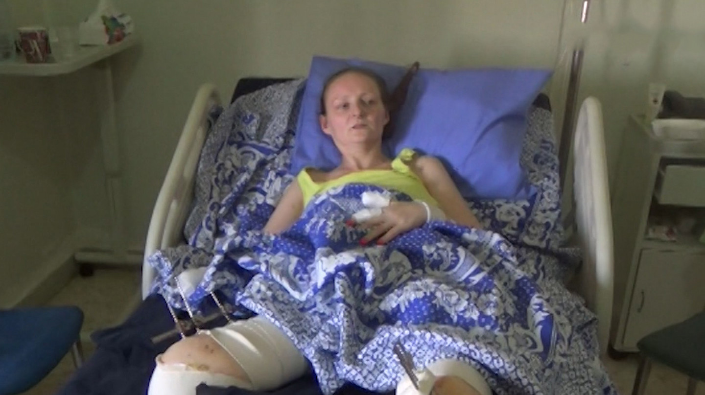 Реалии путинской России – сперва убить, а потом "спасти". Власти РФ "милостиво" разрешили украинке Ирине Баракят приехать на лечение