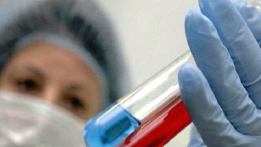 Россию захлестнула болезнь, страшнее СПИДа, - медики бессильны против загадочного недуга