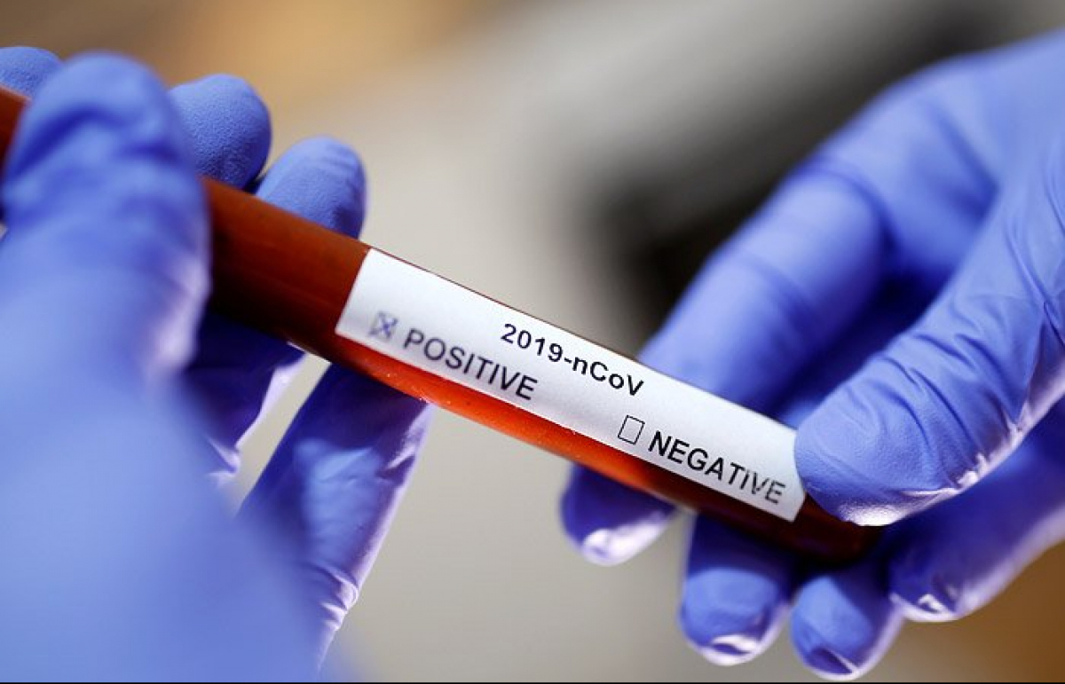 Частная клиника в Киеве скрывала результаты тестов по коронавирусу, началось расследование