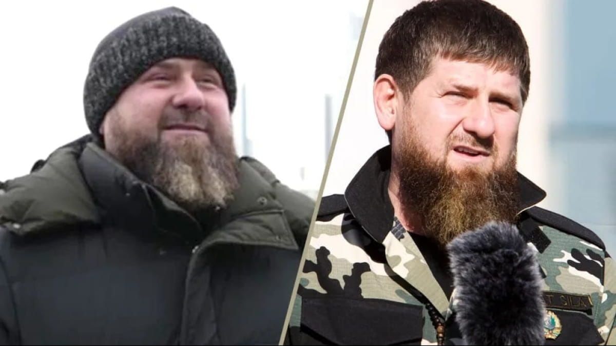Кадыров при смерти: глава Чечни перенес операцию по пересадке почки, но та не прижилась