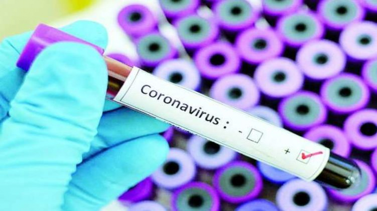 Коронавирус в Украине: уже 84 человека оказались заражены COVID-19, детали