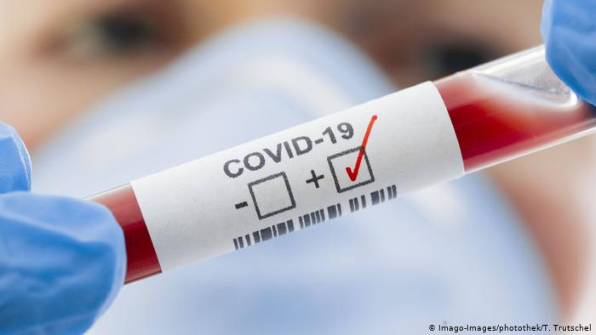 COVID-19 в странах бывшего СССР: ТОП-6 лидеров по заболеваемости коронавирусом
