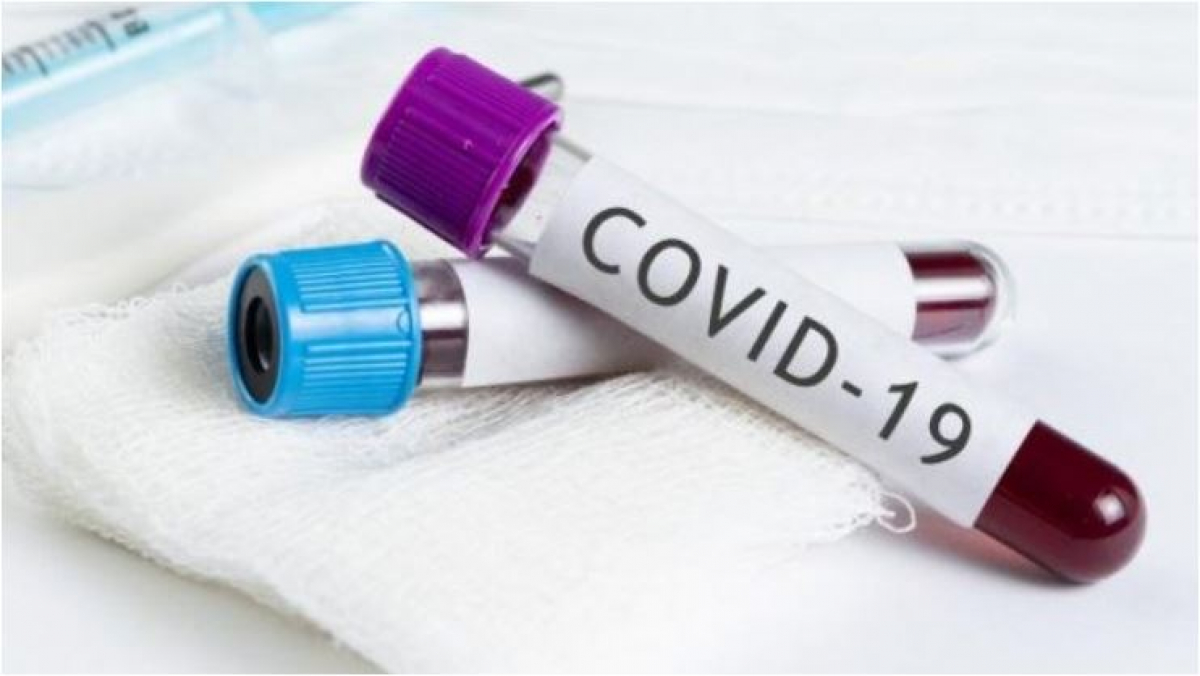 В Украине более 600 новых случаев COVID-19 за сутки - данные на 13 июля 